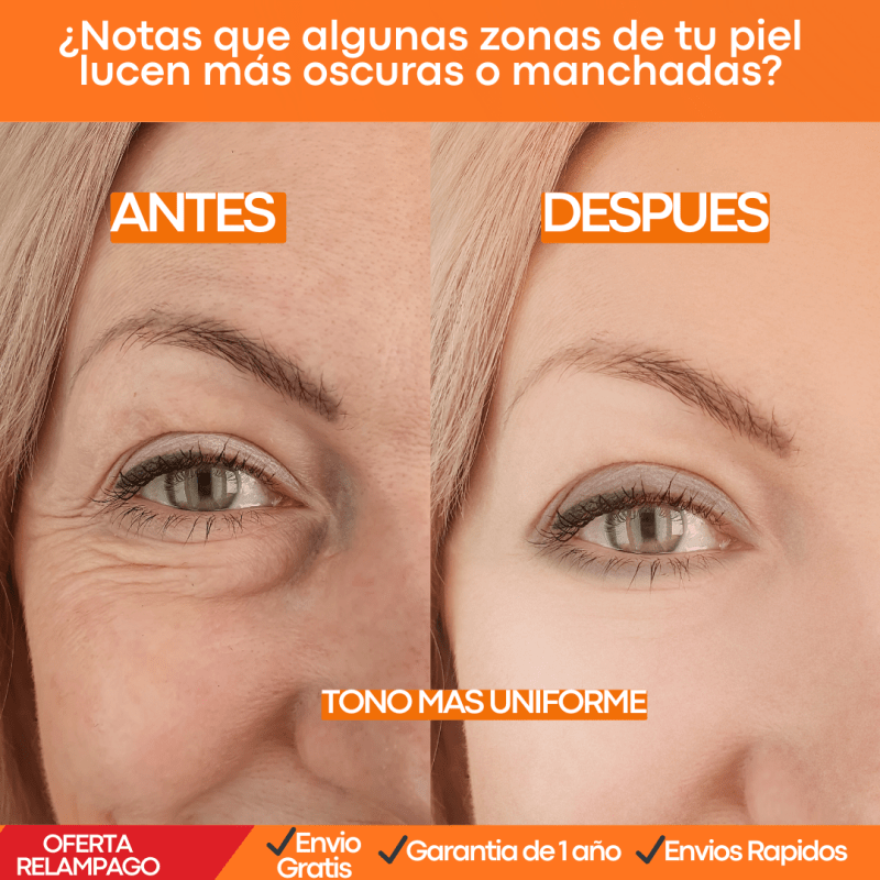 BIOAQUA ORIGINA MAS GARANTIA Crema Aclarante Coreana con Colágeno para Zonas Íntimas, Axilas Labios y Todo el Cuerpo - Tiendu Honduras